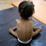 विराटनगरमा २४७ बालबालिका कुपोषित, पोषण आहरा कार्यक्रम पुनः सञ्चालन गर्ने तयारी